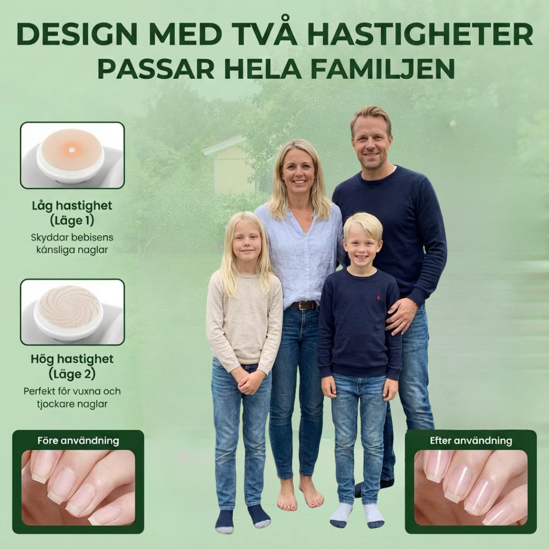 Norillo™ – 2-i-1 nagelklippning och glanspolering utan ansträngning