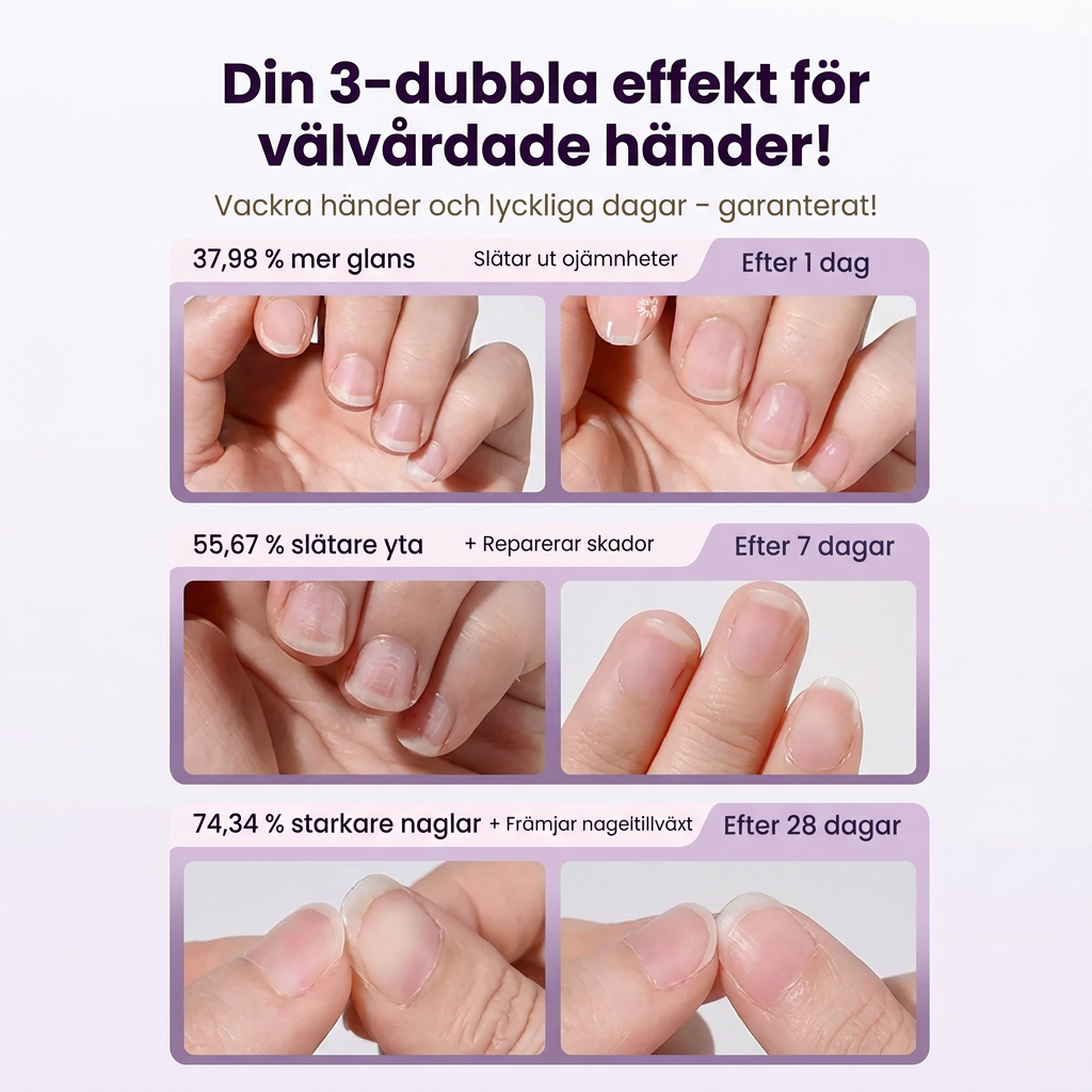 Norillo™ – 2-i-1 nagelbandspenna som löser upp död hud utan skador