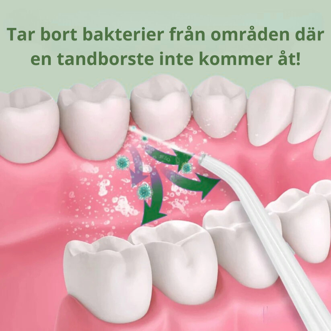 Norillo™ – Effektiv Pulsfloss som Förhindrar Plack, Irritation & bakterier i Tandköttet