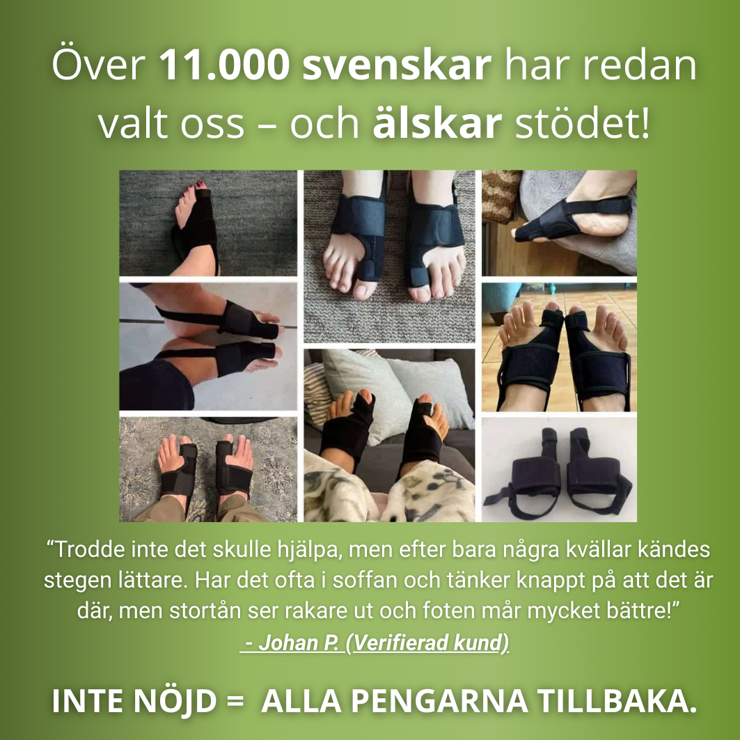 Norillo™ – Stortåstöd som Rätar Hallux Valgus Utan Operation