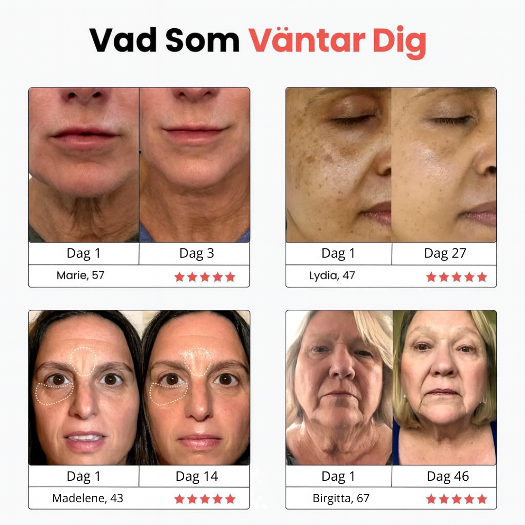 Norillo™ – Reducerar Fina Linjer & Dubbelhaka Hemifrån