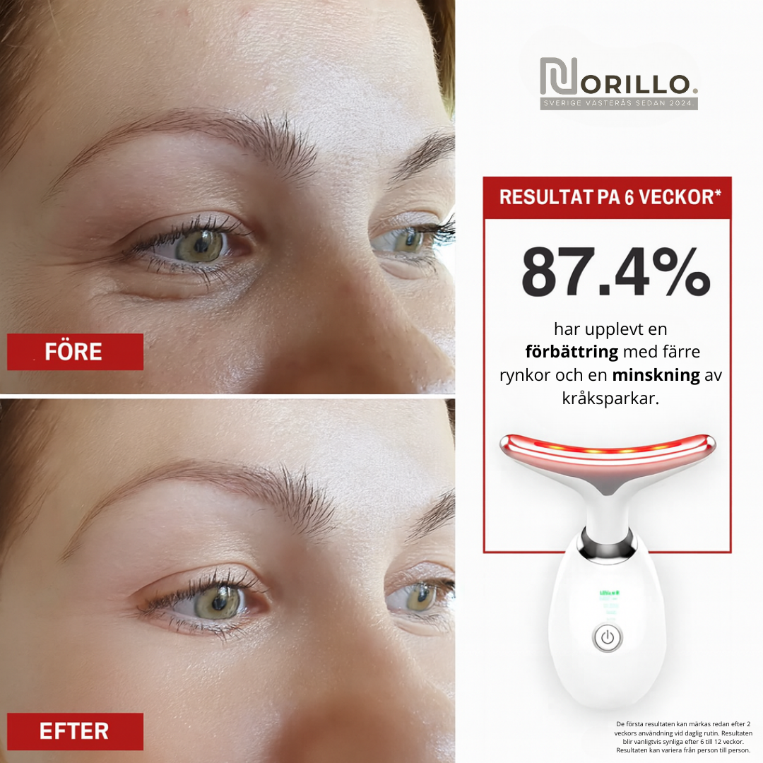 Norillo™ – Reducerar Fina Linjer & Dubbelhaka Hemifrån