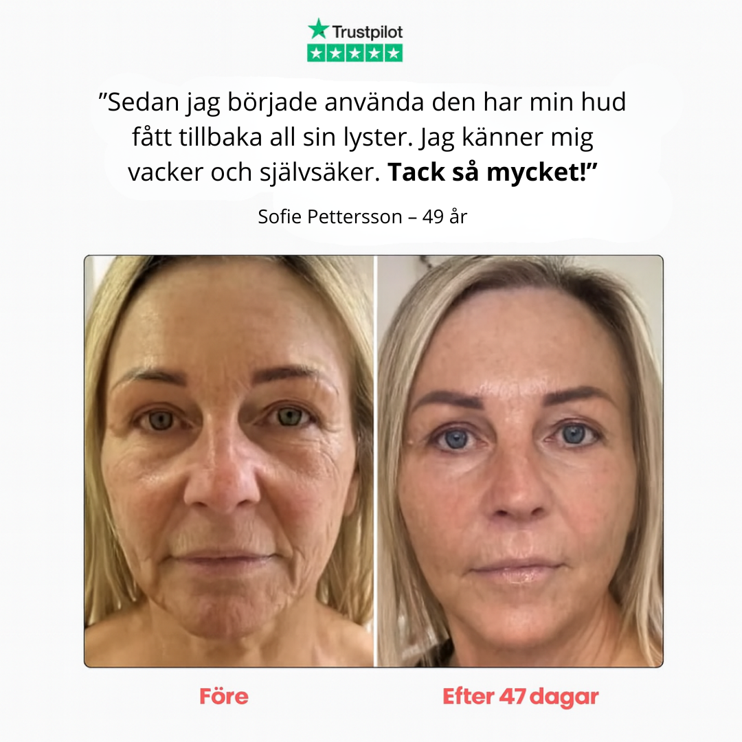 Norillo™ – Reducerar Fina Linjer & Dubbelhaka Hemifrån