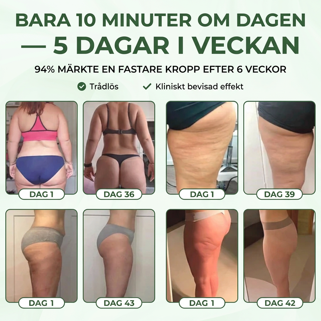 Norillo™ LymfElite – Slätare och fastare hud utan klinikbesök