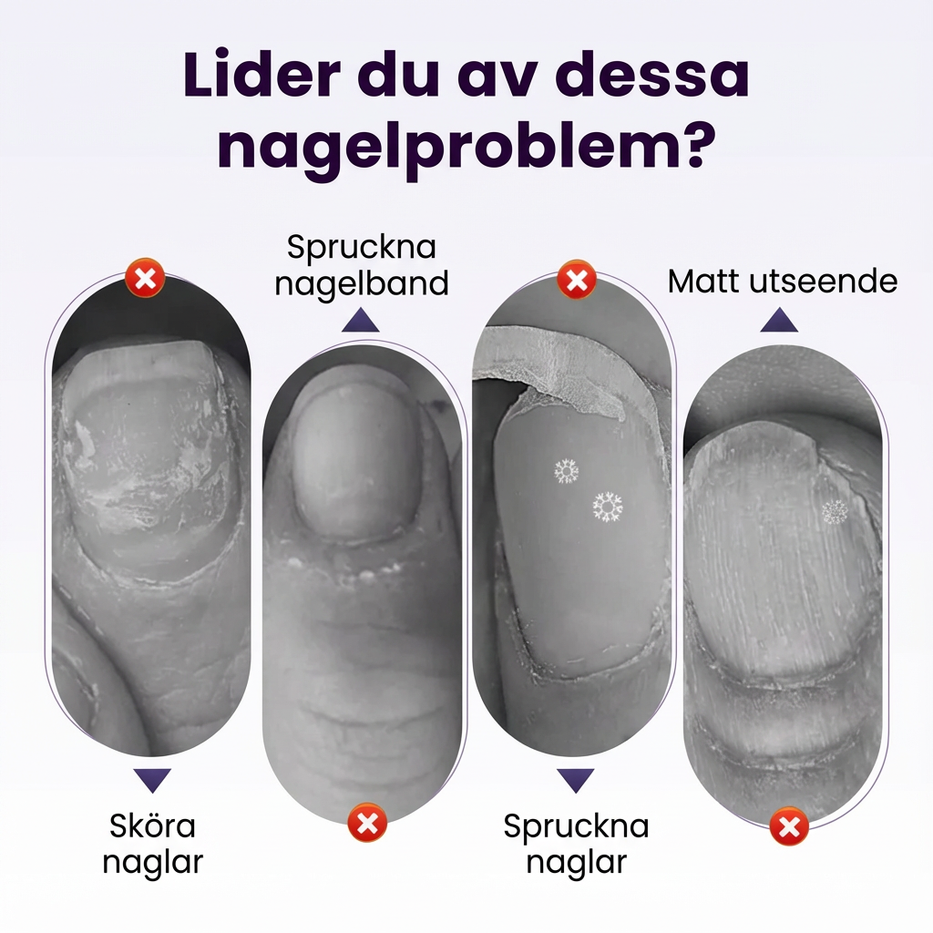 Norillo™ – 2-i-1 nagelbandspenna som löser upp död hud utan skador