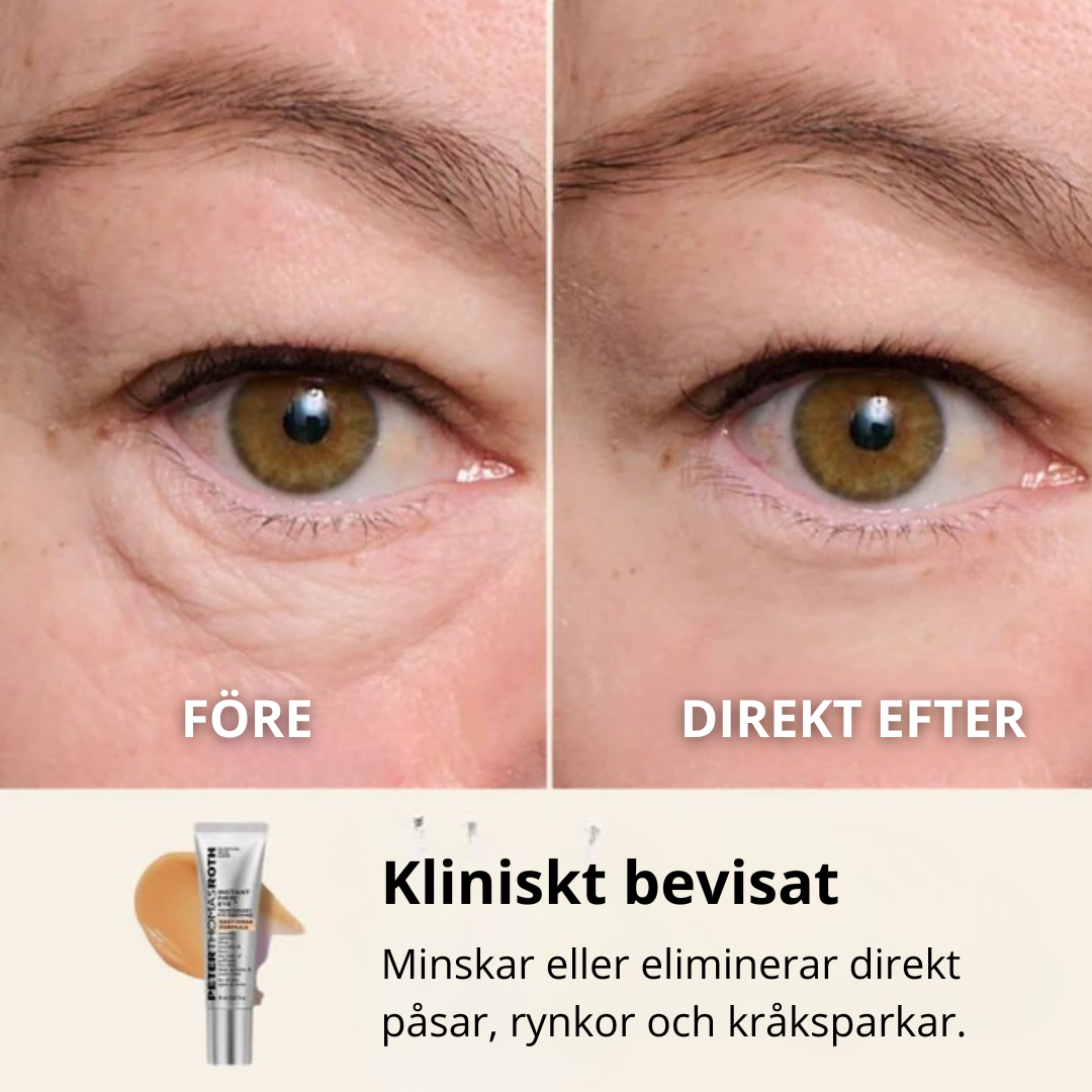 InstantEye™ – Omedelbar Ögonlyft Kräm mot Påsar & Rynkor